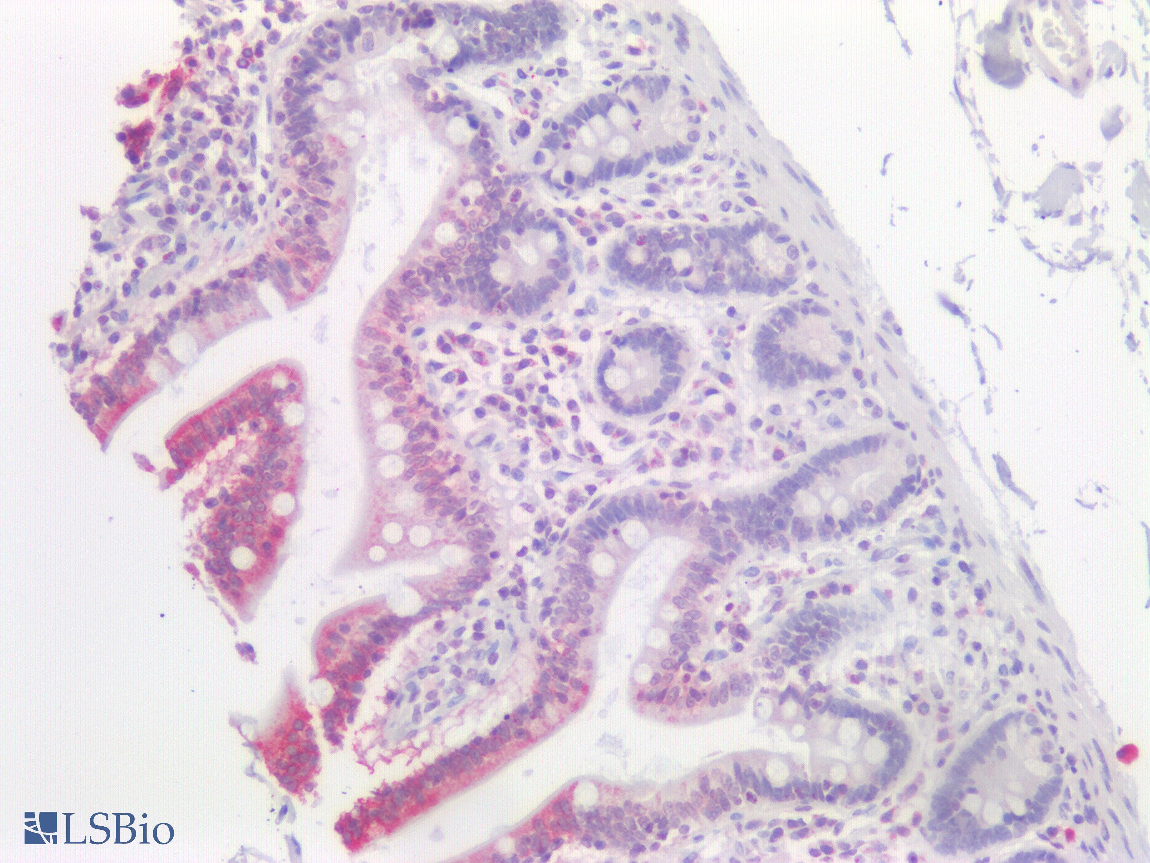 PathPlus™ SLC2A2 / GLUT2 Antibody