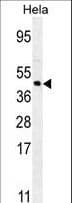 Polyclonal Rabbit anti-Human FOXL2 Antibody (aa3-29, WB)