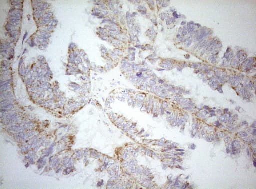 DECR1 Antibody (clone OTI1A6, Carrier-free)