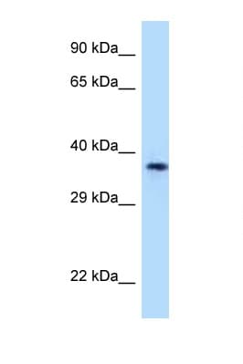Polyclonal Rabbit anti-Human CD1A Antibody (aa203-252, WB)