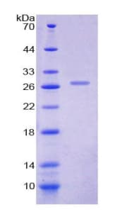 Rat PRL / Prolactin Protein (Recombinant His-T7)