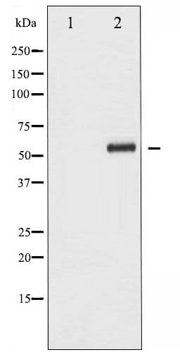 Polyclonal Rabbit anti-Human HDAC1 Antibody (phospho-Ser421, WB)