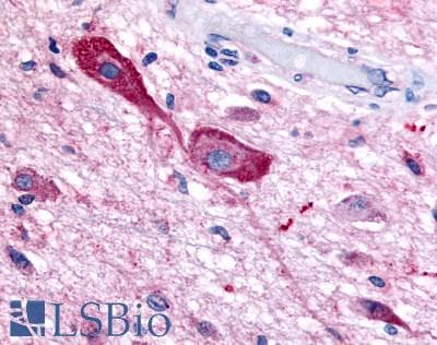 PathPlus™ TRH Receptor / TRHR Antibody (C-Terminus)