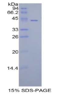 Human HIST1H2AA Protein (Recombinant His-GST)