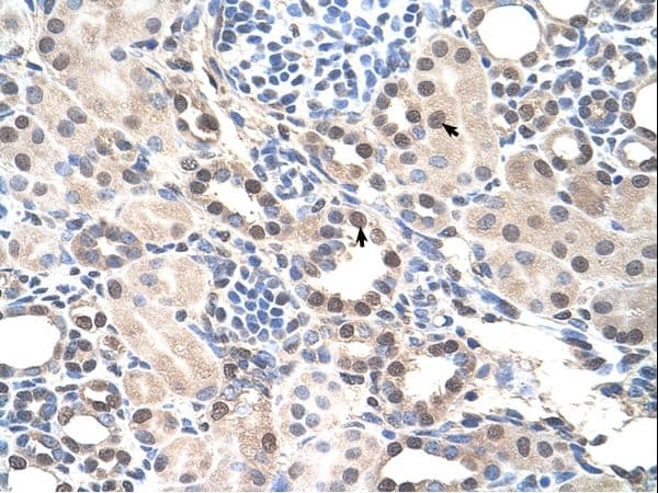 RORA / ROR Alpha Antibody (aa239-288)