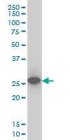 PathPlus™ UCHL1 / PGP9.5 Antibody (clone 1B8-4D2)