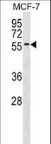 Polyclonal Rabbit anti-Human ZNF787 Antibody (aa1-30, WB)