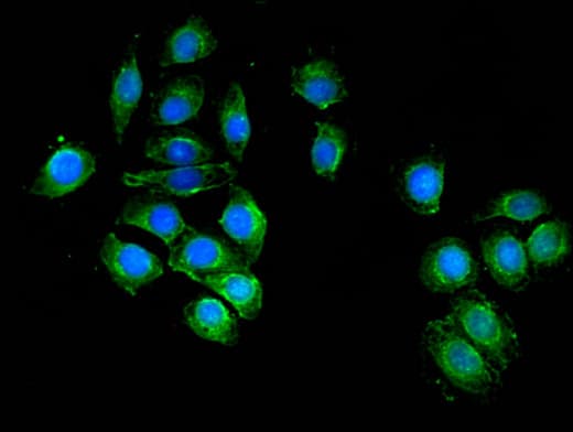 Polyclonal Rabbit anti-Human UAP1 Antibody (IHC, IF, WB)