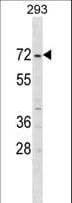 ZNF643 Antibody (aa205-231)