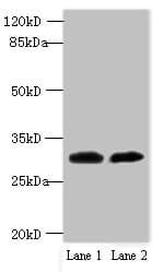 Polyclonal Rabbit anti-Human TRNAU1AP / TRSPAP1 Antibody (IHC, WB)