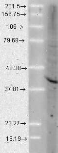 IHC-plus™ AHSA1 / AHA1 Antibody (clone 25F2.D9)