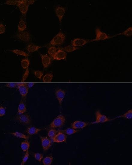 PIK3R4 Antibody