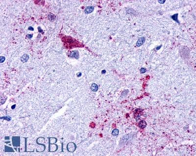 PathPlus™ Polyclonal Rabbit anti-Human LPAR3 / LPA3 / EDG7 Antibody (Cytoplasmic Domain, IHC)