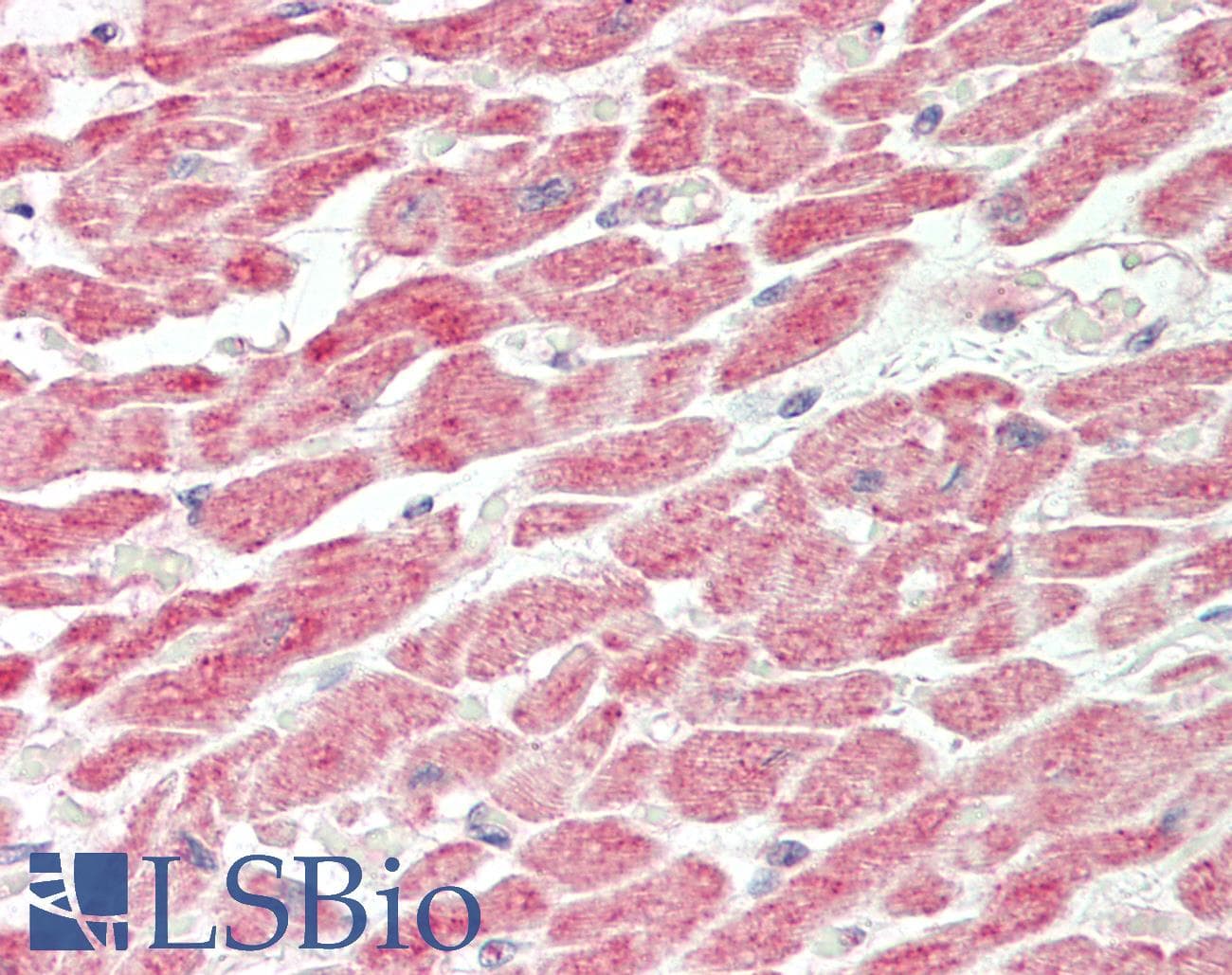 Junctophilin 2 / JPH2 Antibody (aa66-115)