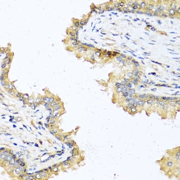 DEFB121 Antibody