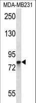 PAD2 / PADI2 Antibody (aa557-586)