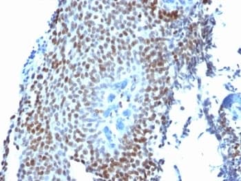 CDKN1A / WAF1 / p21 Antibody (clone CIP1/823)
