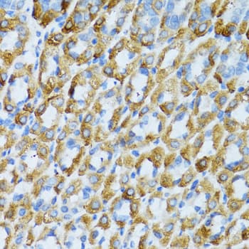 Polyclonal Rabbit anti-Human PSRC1 / DDA3 Antibody (IHC, WB)