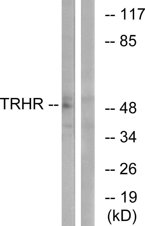 Polyclonal Rabbit anti-Human TRH Receptor / TRHR Antibody (IF, WB)