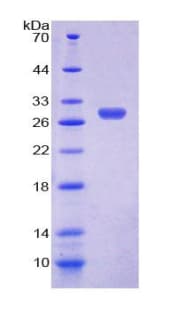 Human NR1A2 / THRB Protein (Recombinant His-T7)