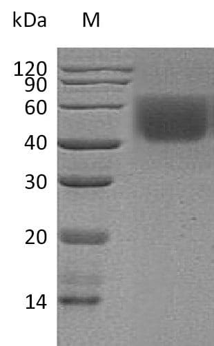Human CD86 Protein (Recombinant 6His, C-terminus)
