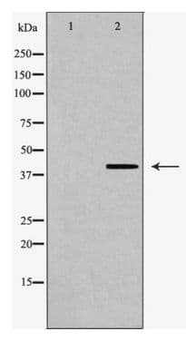 O3FAR1 / GPR120 Antibody