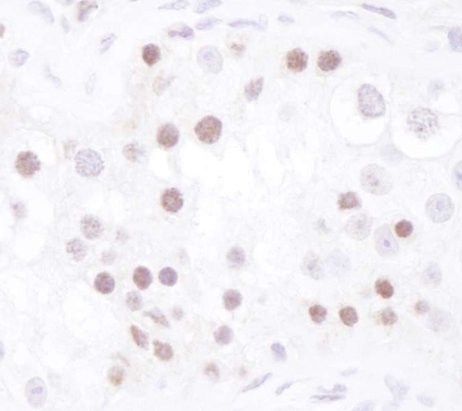 CHEK1 / CHK1 Antibody (aa250-300)