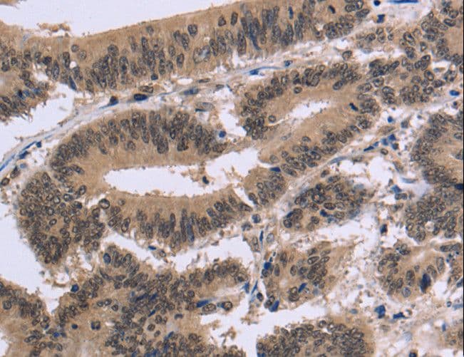 FAM107A / TU3A Antibody