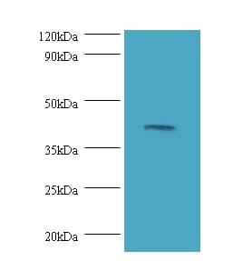 MAP2K3 / MEK3 / MKK3 Antibody (Biotin)