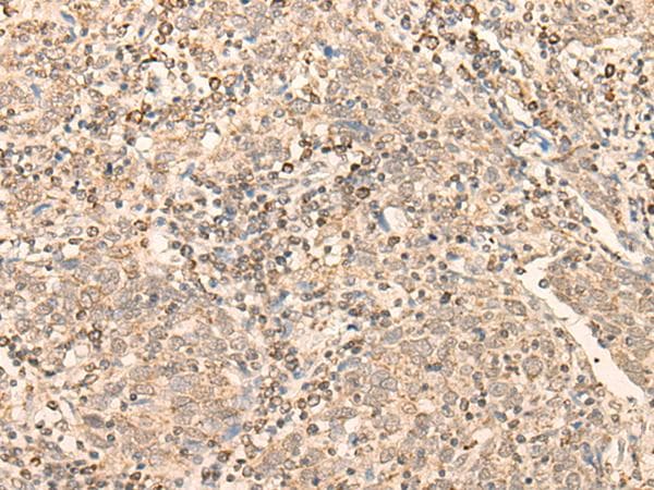 CCNE1 / Cyclin E1 Antibody