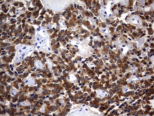 CSNK1G2 / CKI-Gamma 2 Antibody (aa163-415, clone OTI4H3)