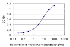 IHC-plus™ Monoclonal Mouse anti-Human MYOC / Myocilin Antibody (clone 4F8, IHC, WB)