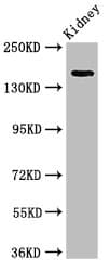 Polyclonal Rabbit anti-Human USP6 / HRP1 Antibody (IHC, IF, WB)