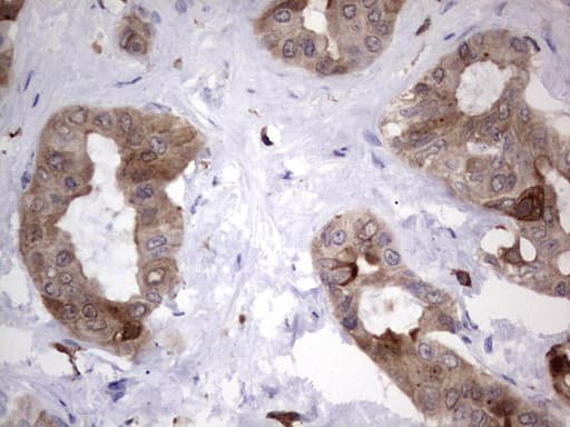 LGALS3 / Galectin 3 Antibody (clone OTI9C7)