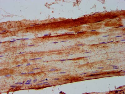 PHKA1 Antibody