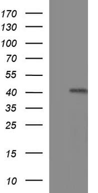 TXNDC5 / ERP46 Antibody (clone OTI2E6)