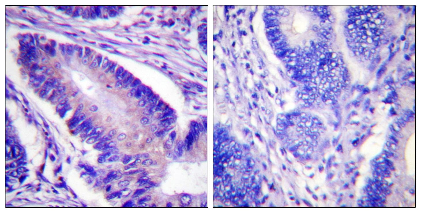 EIF4B Antibody (phospho-Ser422)
