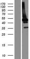 HERPUD1 / HERP Protein (Over-Expression Lysate Myc-DDK (Flag))