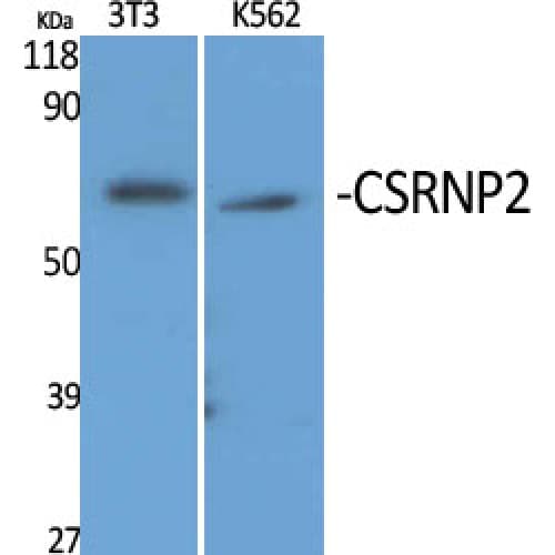 Polyclonal Rabbit anti-Human CSRNP2 / FAM130A1 Antibody (60-140 aa, Internal, IHC, WB)