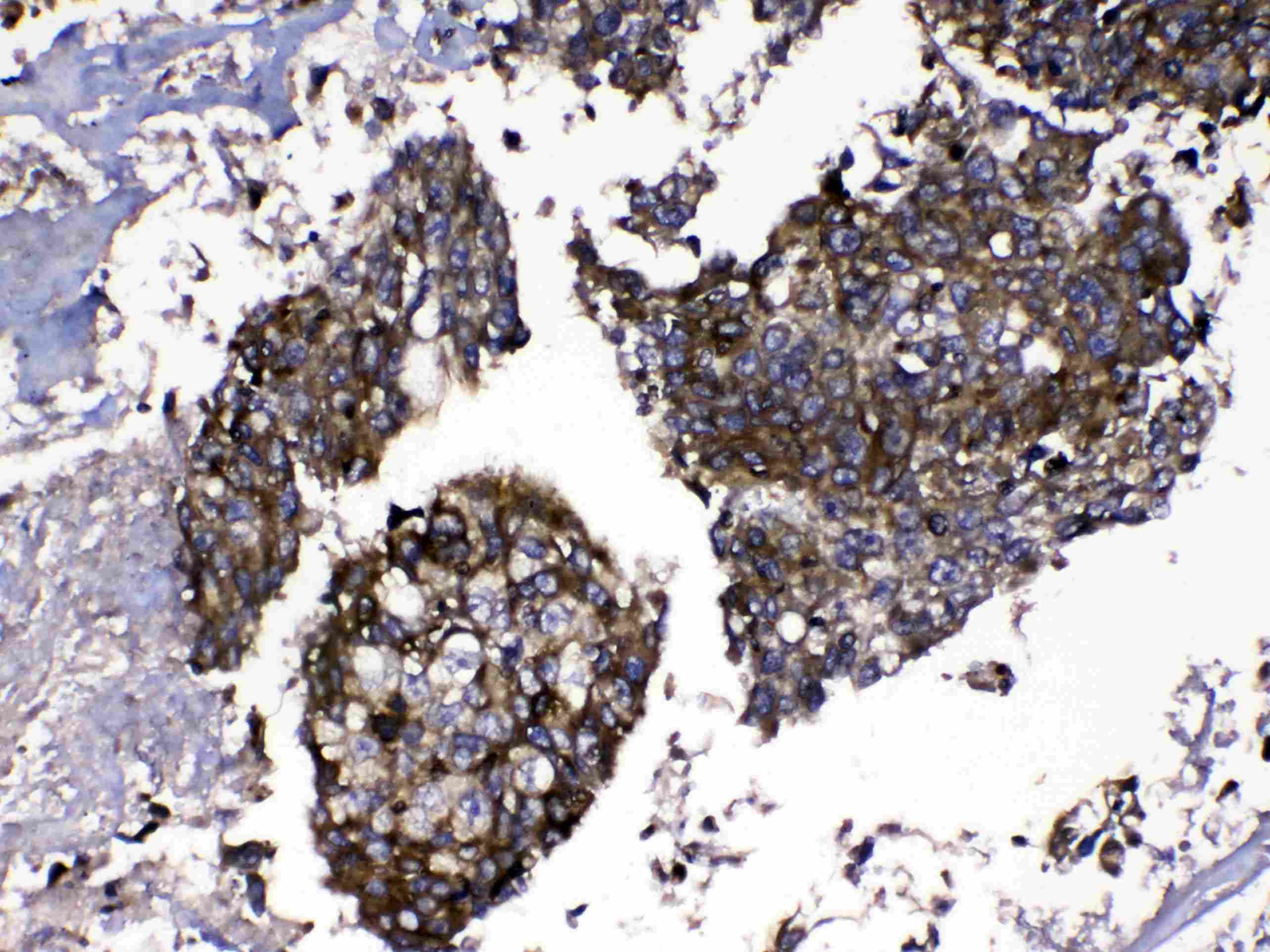 MMP16 Antibody