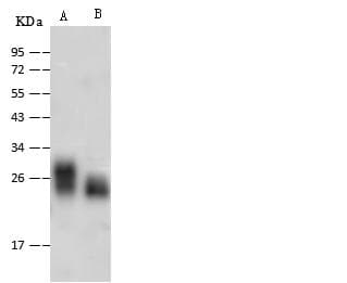 Polyclonal Rabbit anti-Rat AK1 / Adenylate Kinase 1 Antibody (Preservative Free, WB)