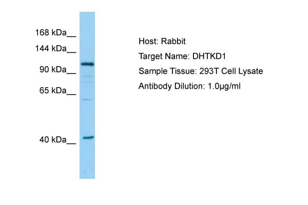 DHTKD1 Antibody (aa126-175)