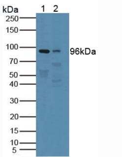 PTPRN / IA-2 Antibody (aa35-185)