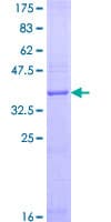 Human RAMP1 Protein (Recombinant GST)