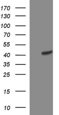 TXNDC5 / ERP46 Antibody (clone OTI1C1)