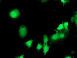 EIF2B3 Antibody (clone OTI1A4)