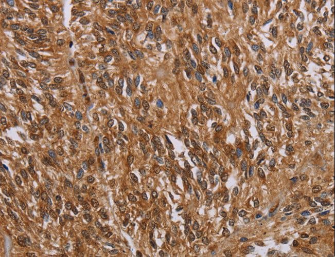 KARS Antibody