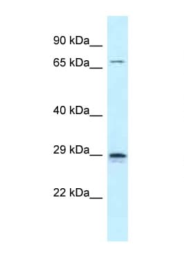 NEUROG2 / NGN2 / Neurogenin 2 Antibody (C-Terminus)