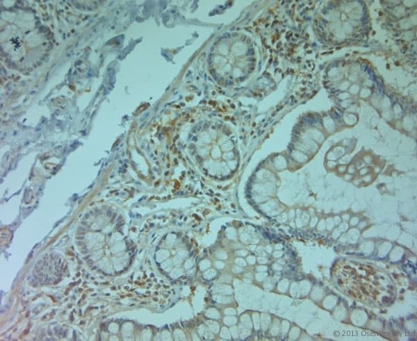 PLIN4 / S3-12 Antibody (aa1050-1100)