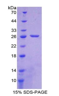 Human Complement C1QA Protein (Recombinant His, N-Terminal)
